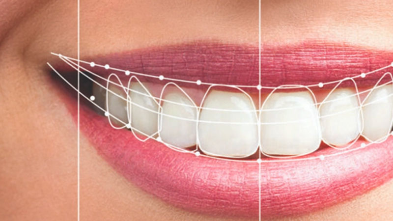 patient from united kingdom undergoing dental treatment at the smile spa dental clinic juhu mumbai