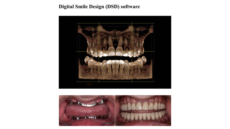 digital smile design software