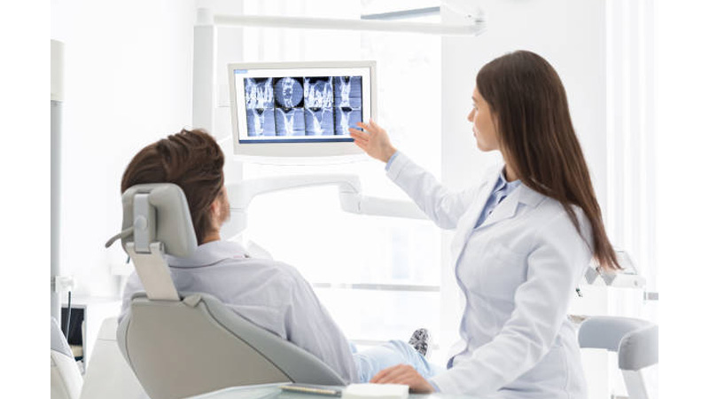 Implant planning using CBCT scans