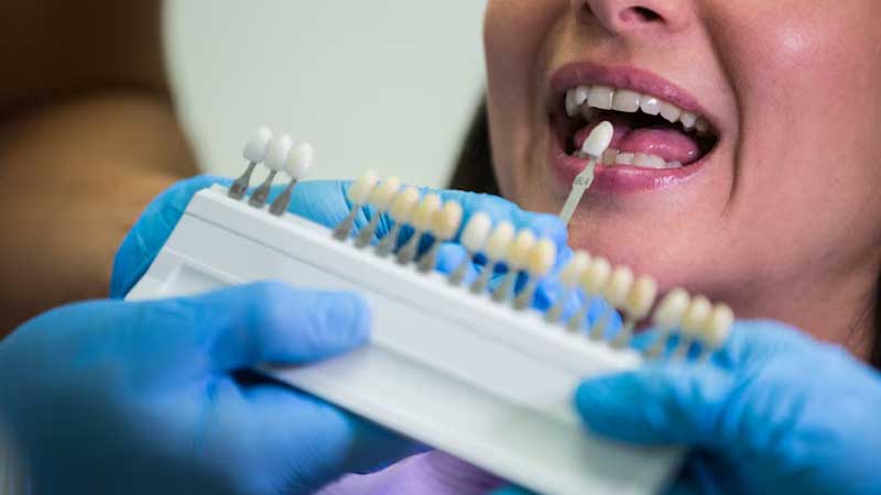 crowns can be matched to the color of your natural teeth