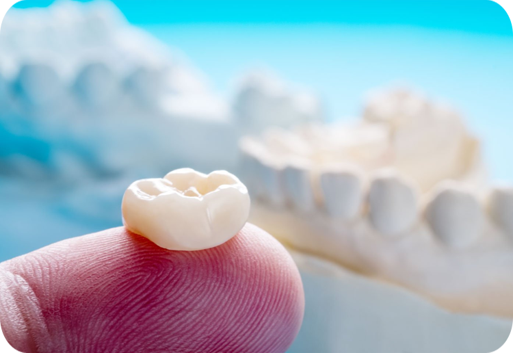 Improve the appearance of an abnormally shaped tooth with crown bridges 