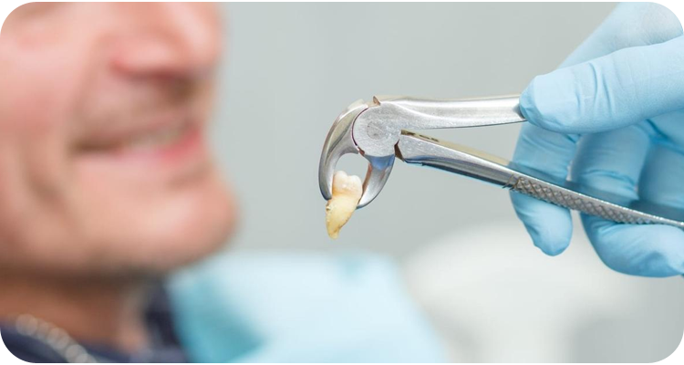 Extracted tooth is being hold by dentist with help of tool
