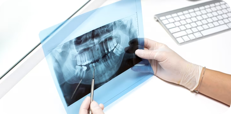 Dentist holding x-ray of the teeth of patient