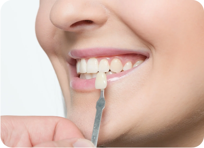 With a wide range of options like aesthetic composite fillings, teeth whitening and ceramic veneers, The Smile Spa can set your smile just right!