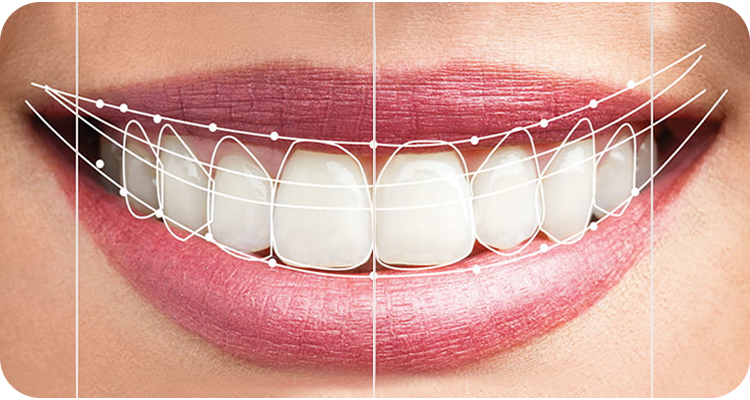 Smile Designing corrects teeth imperfections while also restoring dental health and appearance.